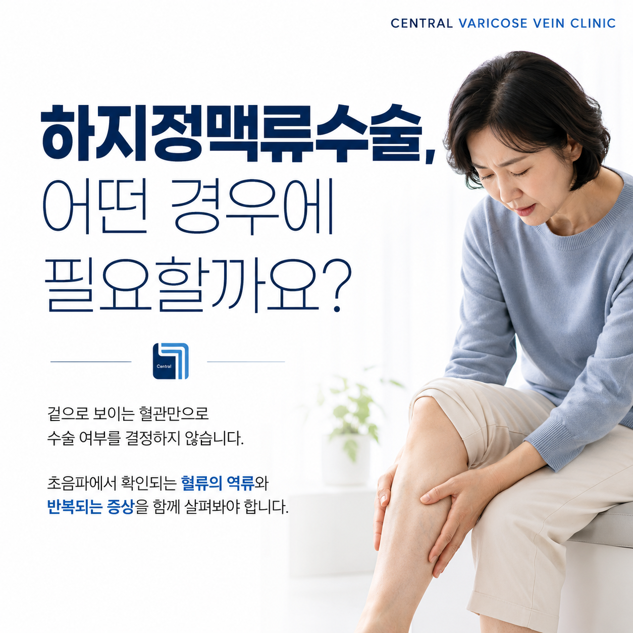 하지정맥류 수술이 필요한 때