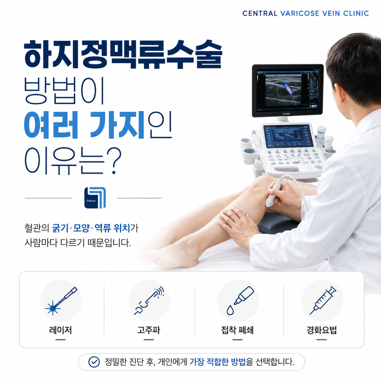 하지정맥류수술 방법이 여러 개인 이유