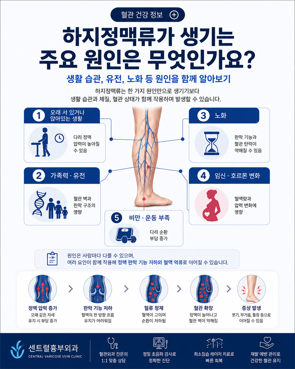 하지정맥류의 주요 원인과 위험 요인 안내